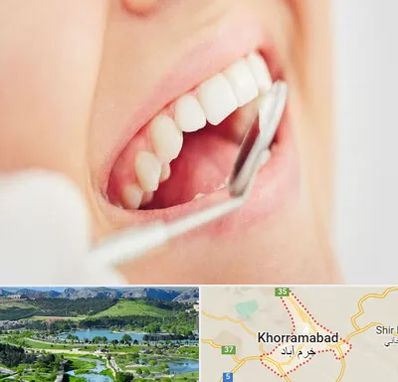 اصلاح طرح لبخند در خرم آباد