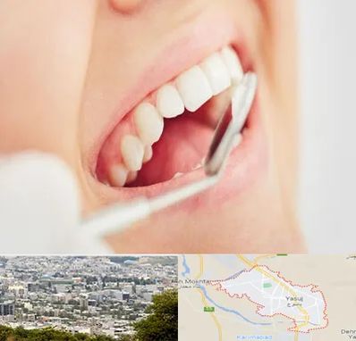 اصلاح طرح لبخند در یاسوج