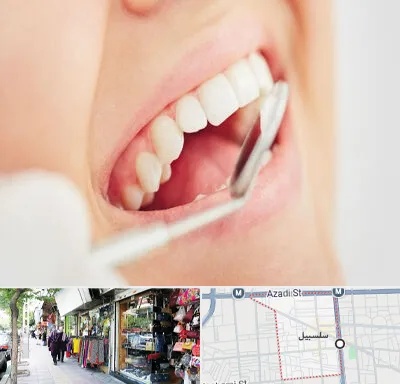 اصلاح طرح لبخند در سلسبیل