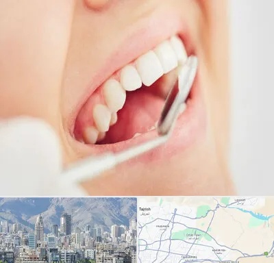 اصلاح طرح لبخند در شمال شرق تهران