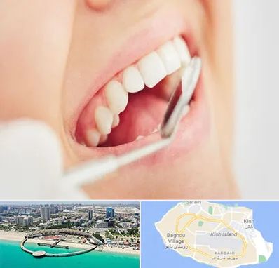 اصلاح طرح لبخند در کیش