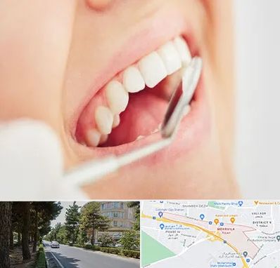 اصلاح طرح لبخند در مهرویلا کرج