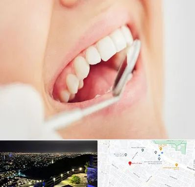 اصلاح طرح لبخند در هفت تیر مشهد