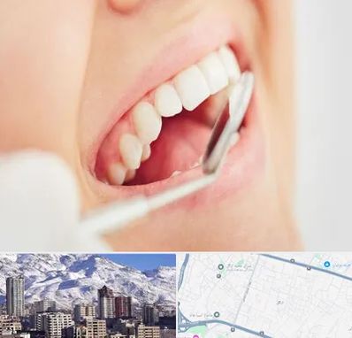 اصلاح طرح لبخند در ازگل