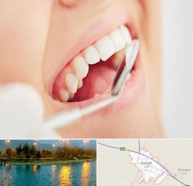اصلاح طرح لبخند در قروه