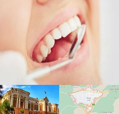 اصلاح طرح لبخند در خوی