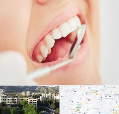 اصلاح طرح لبخند در دیباجی