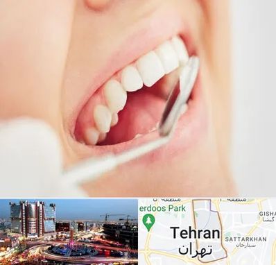 اصلاح طرح لبخند در صادقیه 