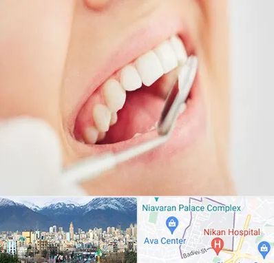 اصلاح طرح لبخند در آجودانیه 