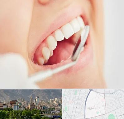 اصلاح طرح لبخند در جمشیدیه