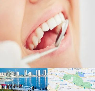 اصلاح طرح لبخند در چیتگر 