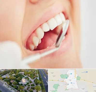 اصلاح طرح لبخند در کاشمر