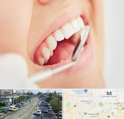 اصلاح طرح لبخند در جنوب تهران 