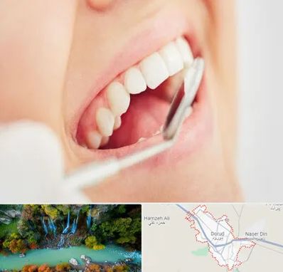 اصلاح طرح لبخند در دورود