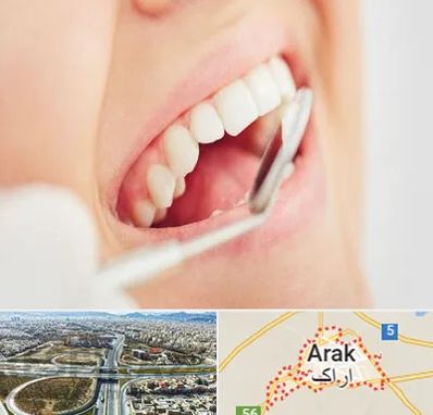 اصلاح طرح لبخند در اراک