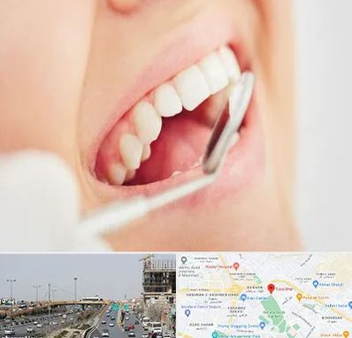 اصلاح طرح لبخند در بلوار توس مشهد