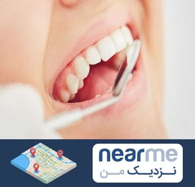 اصلاح طرح لبخند در نزدیک من