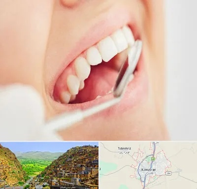 اصلاح طرح لبخند در کامیاران
