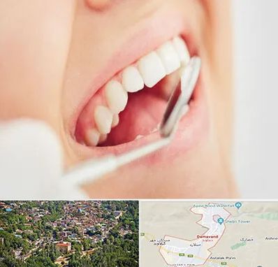 اصلاح طرح لبخند در دماوند