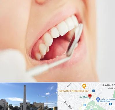 اصلاح طرح لبخند در فلکه گاز شیراز