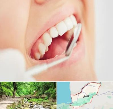 اصلاح طرح لبخند در گلستان