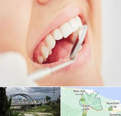 اصلاح طرح لبخند در چالوس