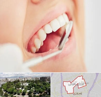 اصلاح طرح لبخند در نیروی هوایی