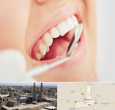 اصلاح طرح لبخند در سبزوار