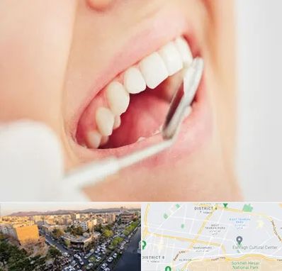 اصلاح طرح لبخند در تهرانپارس 