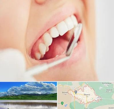 اصلاح طرح لبخند در مرند