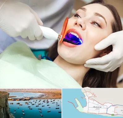 دندانپزشکی بدون درد در چابهار