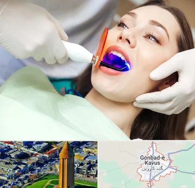 دندانپزشکی بدون درد در گنبد کاووس