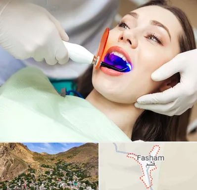 دندانپزشکی بدون درد در فشم