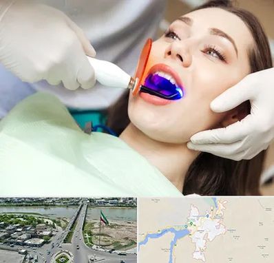 دندانپزشکی بدون درد در میاندوآب