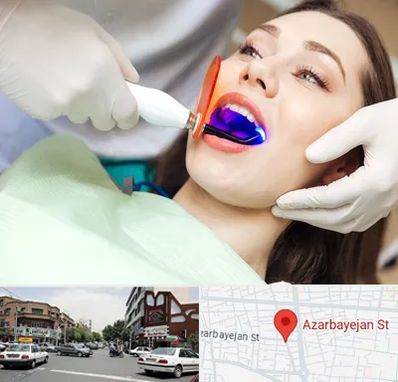 دندانپزشکی بدون درد در خیابان آذربایجان