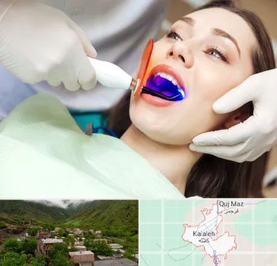 دندانپزشکی بدون درد در کلاله