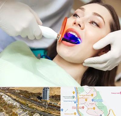 دندانپزشکی بدون درد در خیابان نیایش شیراز