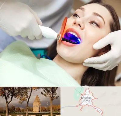 دندانپزشکی بدون درد در تویسرکان