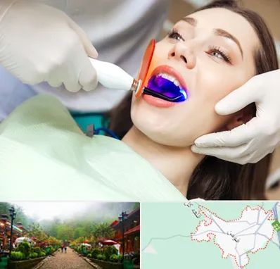 دندانپزشکی بدون درد در فومن