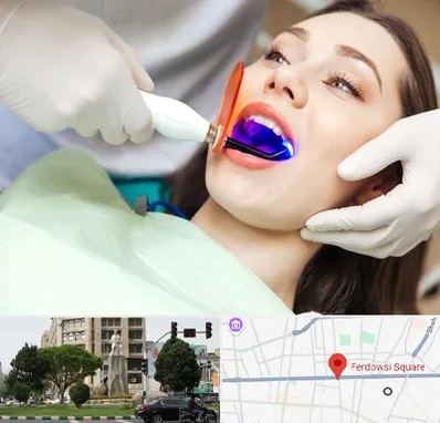دندانپزشکی بدون درد در میدان فردوسی تهران