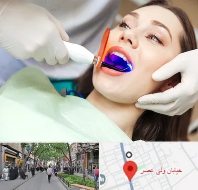 دندانپزشکی بدون درد در ولیعصر شهریار