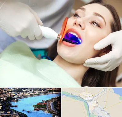 دندانپزشکی بدون درد در خرمشهر