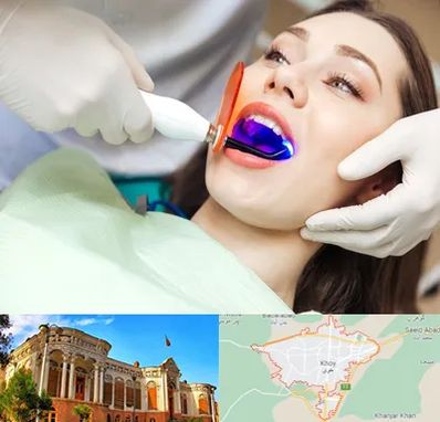 دندانپزشکی بدون درد در خوی