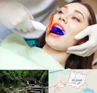 دندانپزشکی بدون درد در علی آباد کتول