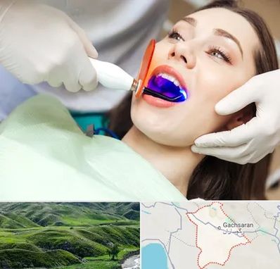 دندانپزشکی بدون درد در گچساران