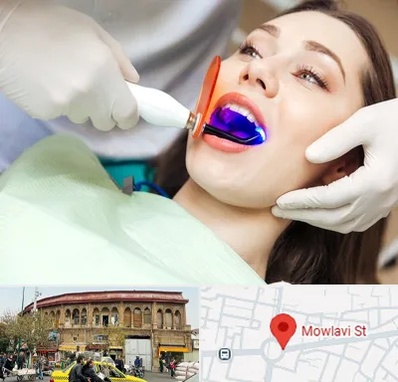 دندانپزشکی بدون درد در مولوی
