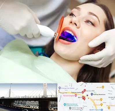 دندانپزشکی بدون درد در پارک وی 