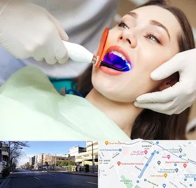 دندانپزشکی بدون درد در خیابان ملاصدرا شیراز