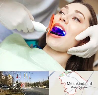 دندانپزشکی بدون درد در مشکین دشت