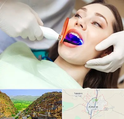 دندانپزشکی بدون درد در کامیاران